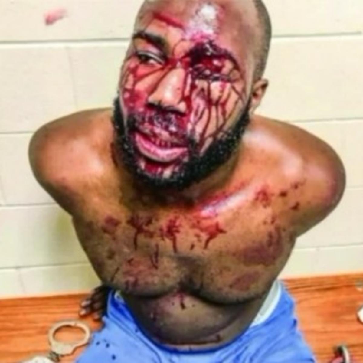 Mississippi Man Beaten By Police Officers Files $1 Million Lawsuit