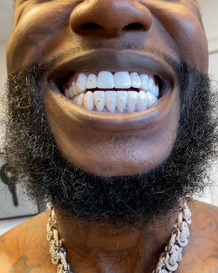 Reageren deadline katje Gucci Mane Shows Off His $250K Diamond Encrusted Teeth - Amebo Book